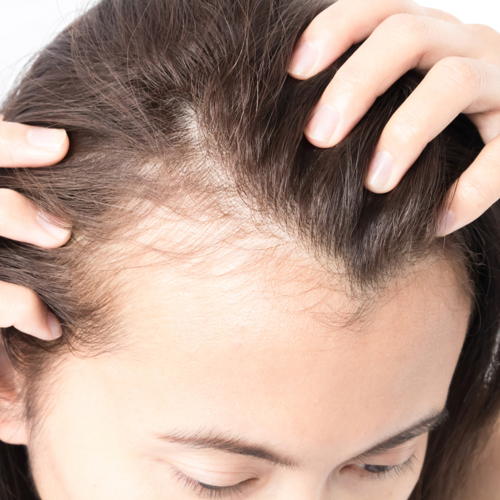 Hairloss treatment parma ohio